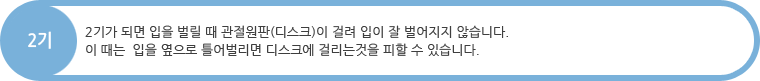 2기 : 2기가 되면 입을 벌릴 때 관절원판(디스크)이 걸려 입이 잘 벌어지지 않습니다.