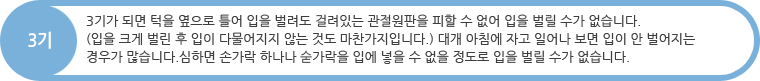 3기 : 3기가 되면 턱을 옆으로 틀어 입을 벌려도 걸려있는 관절원판을 피할 수 없어 입을 벌릴 수가 없습니다. (입을 크게 벌린 후 입이 다물어지지 않는 것도 마찬가지입니다.) 대개 아침에 자고 일어나 보면 입이 안 벌어지는 경우가 많습니다.심하면 손가락 하나나 숟가락을 입에 넣을 수 없을 정도로 입을 벌릴 수가 없습니다.